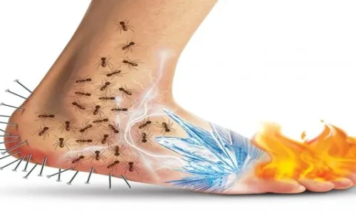 Periferik neyropatiya sebebleri, elametleri ve mualicesi nedir?