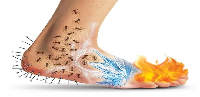 Periferik neyropatiya sebebleri, elametleri ve mualicesi nedir?